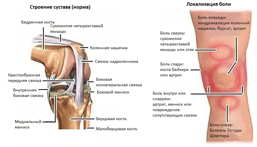 Строение коленного сустава и причины болей