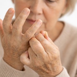 Лечение ревматоидного артрита у женщин