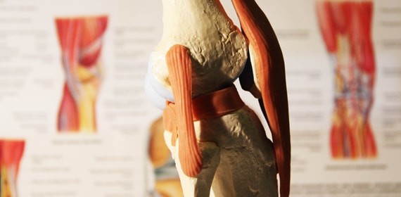 Артрит коленного сустава