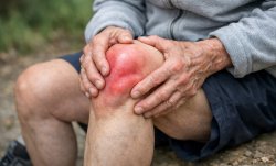 Ревматоидный артрит коленного сустава