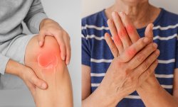 Ревматоидный артрит