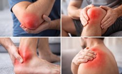 Симптомы бурсита