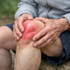 Ревматоидный артрит коленного сустава