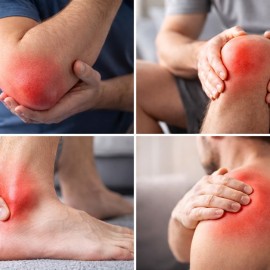 Симптомы бурсита