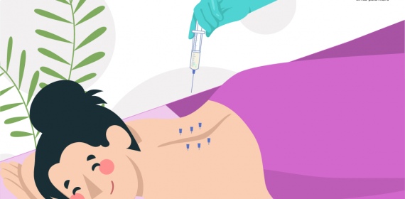 Фармакопунктура