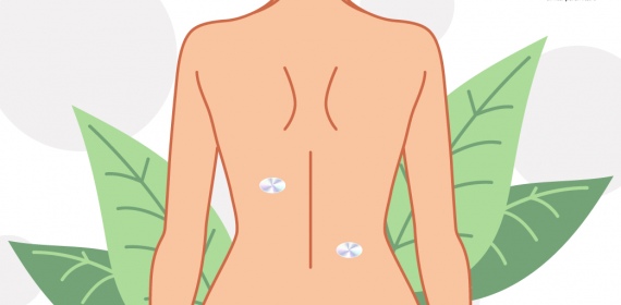 Голограммотерапия