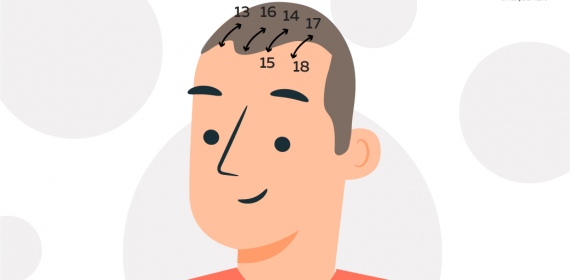 Скальп-терапия