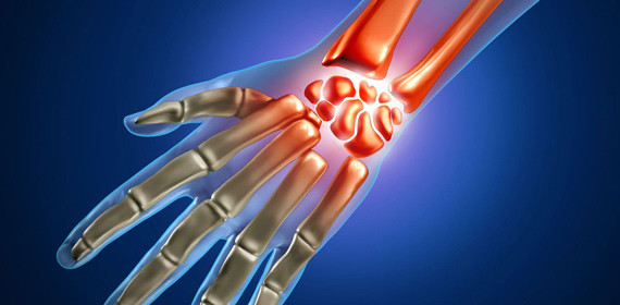 Боль и скованность в кистях рук и пальцах