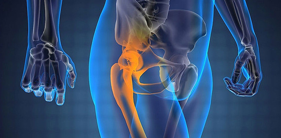 Боль в ягодице