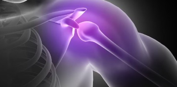 Боль в плече при поднятии руки