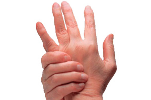 Профилактика кистевого артроза