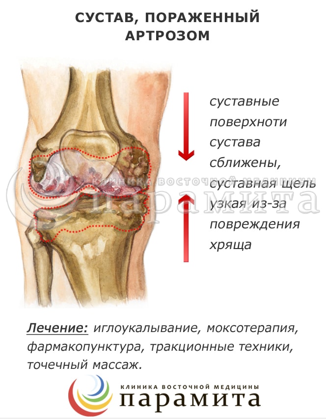 Что это когда глотаешь болит и отдает в шею