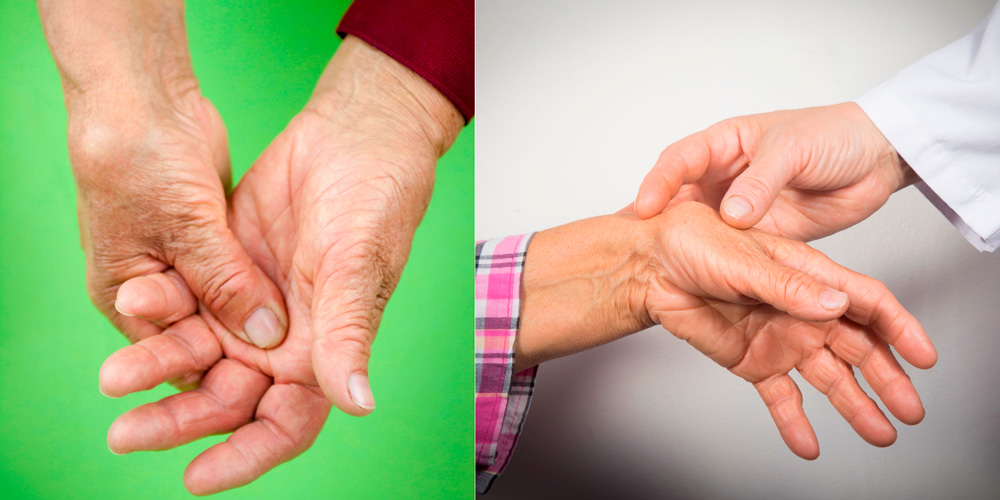 Способы лечения новообразований на пальцах