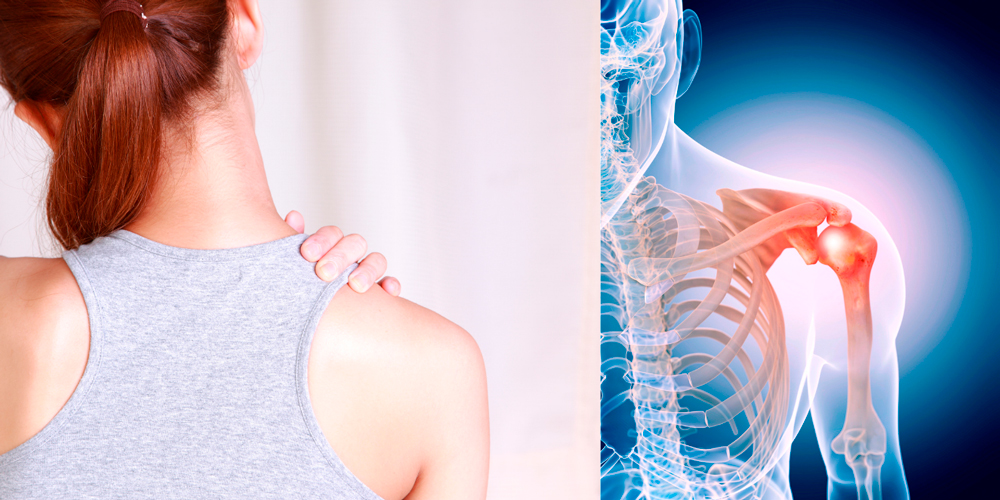 Симптомы плечевого артроза