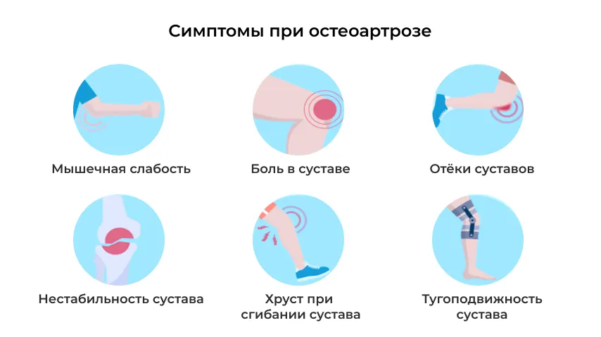 Симптомы остеоартроза