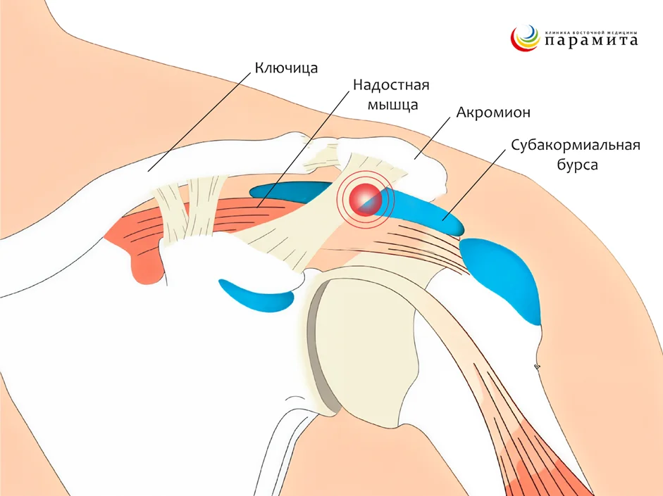 Расположение бурс в плечевом суставе