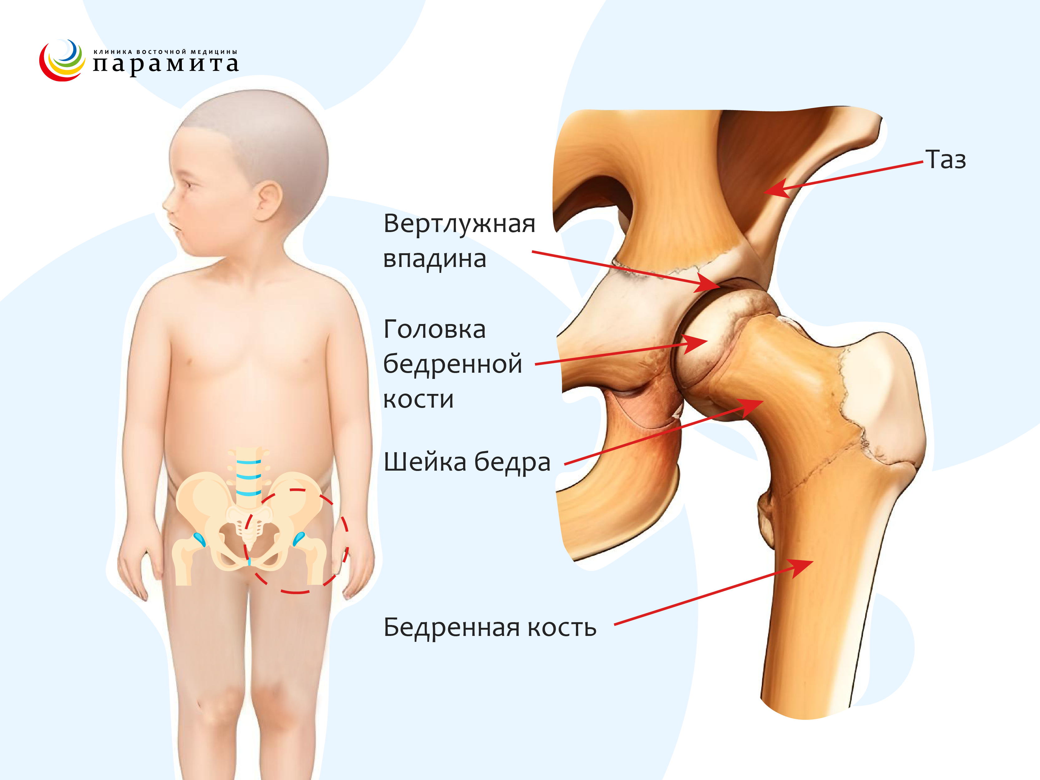 Юношеский идиопатический артрит