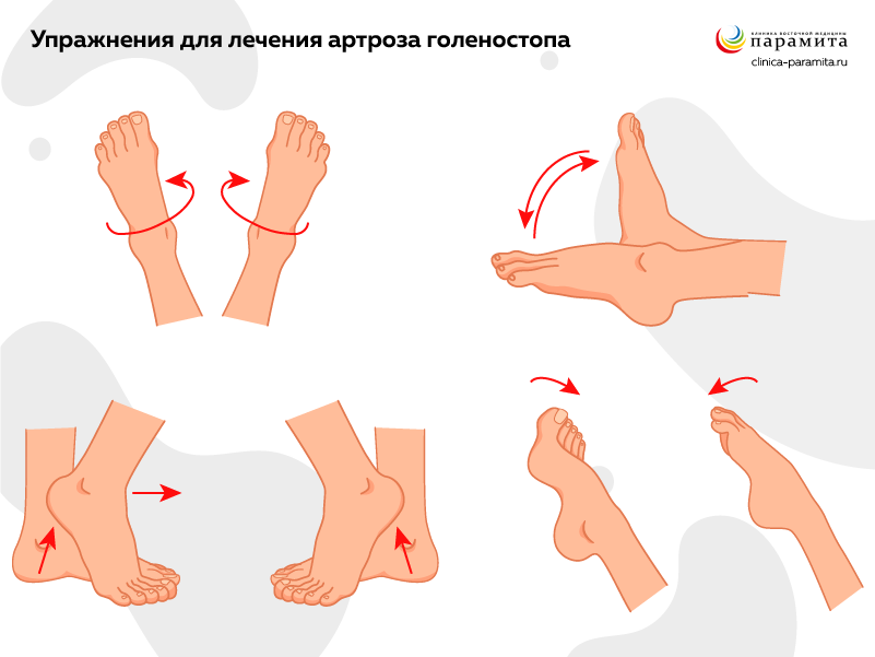 Диета при артрозе суставов | Санаторий Горный