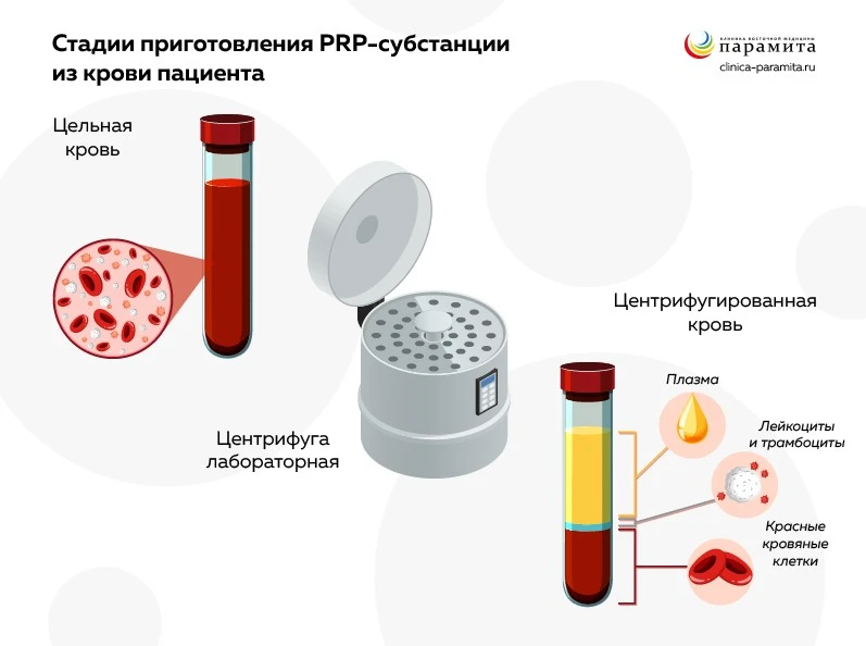 Суставы (комплекс)