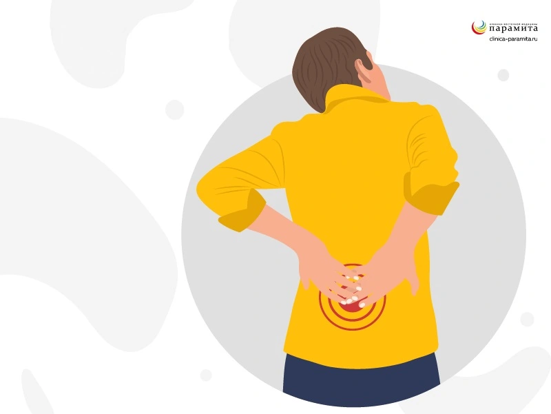 Миозит - одна из причин боли в спине выше поясницы