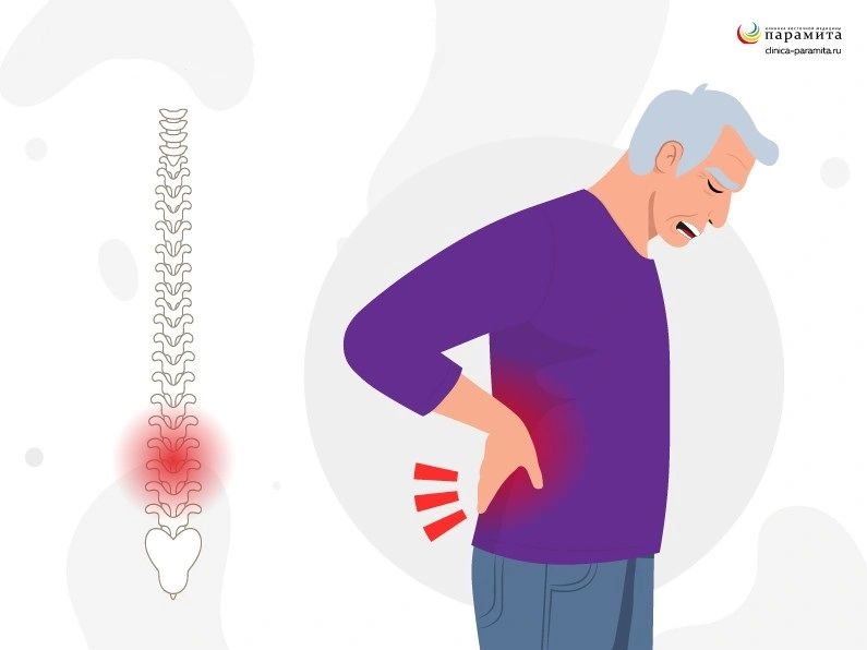 Дегенеративные изменения поясничного отдела позвоночника