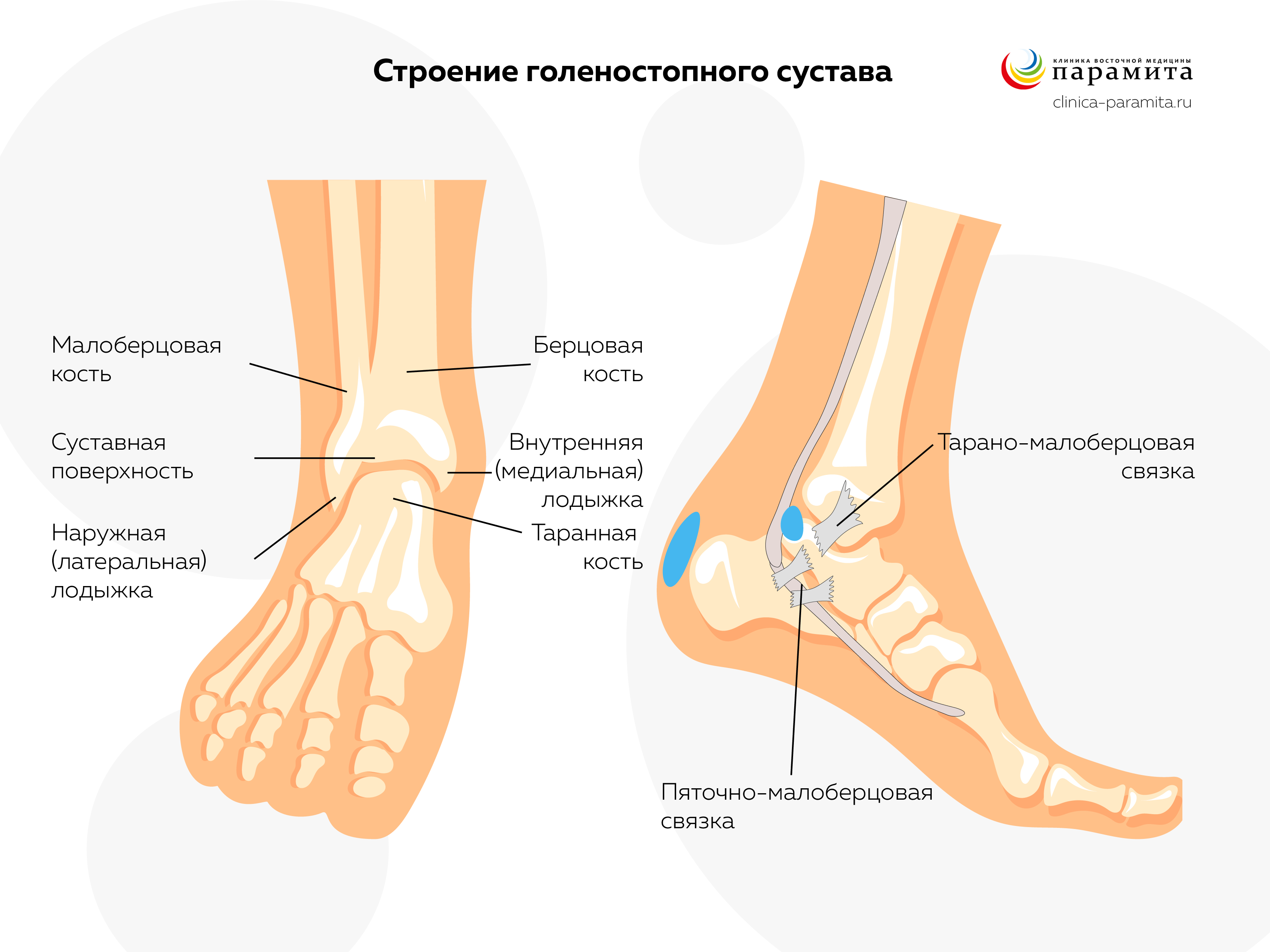 Бурсит лодыжки