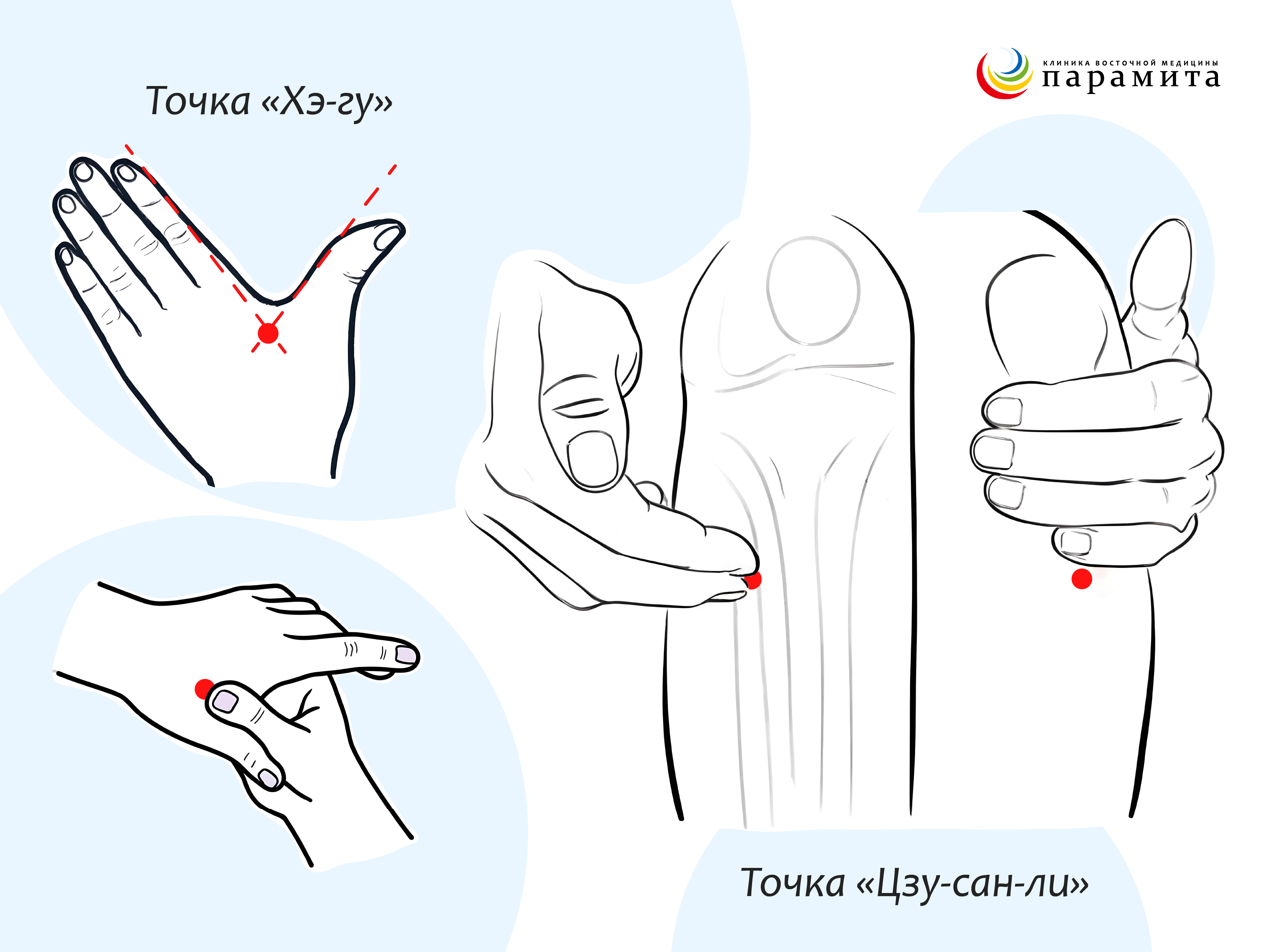 Точки для иглоукалывания при неврозе