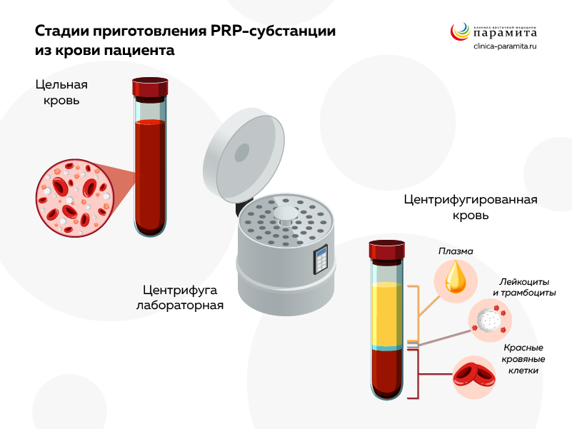 Статьи по теме