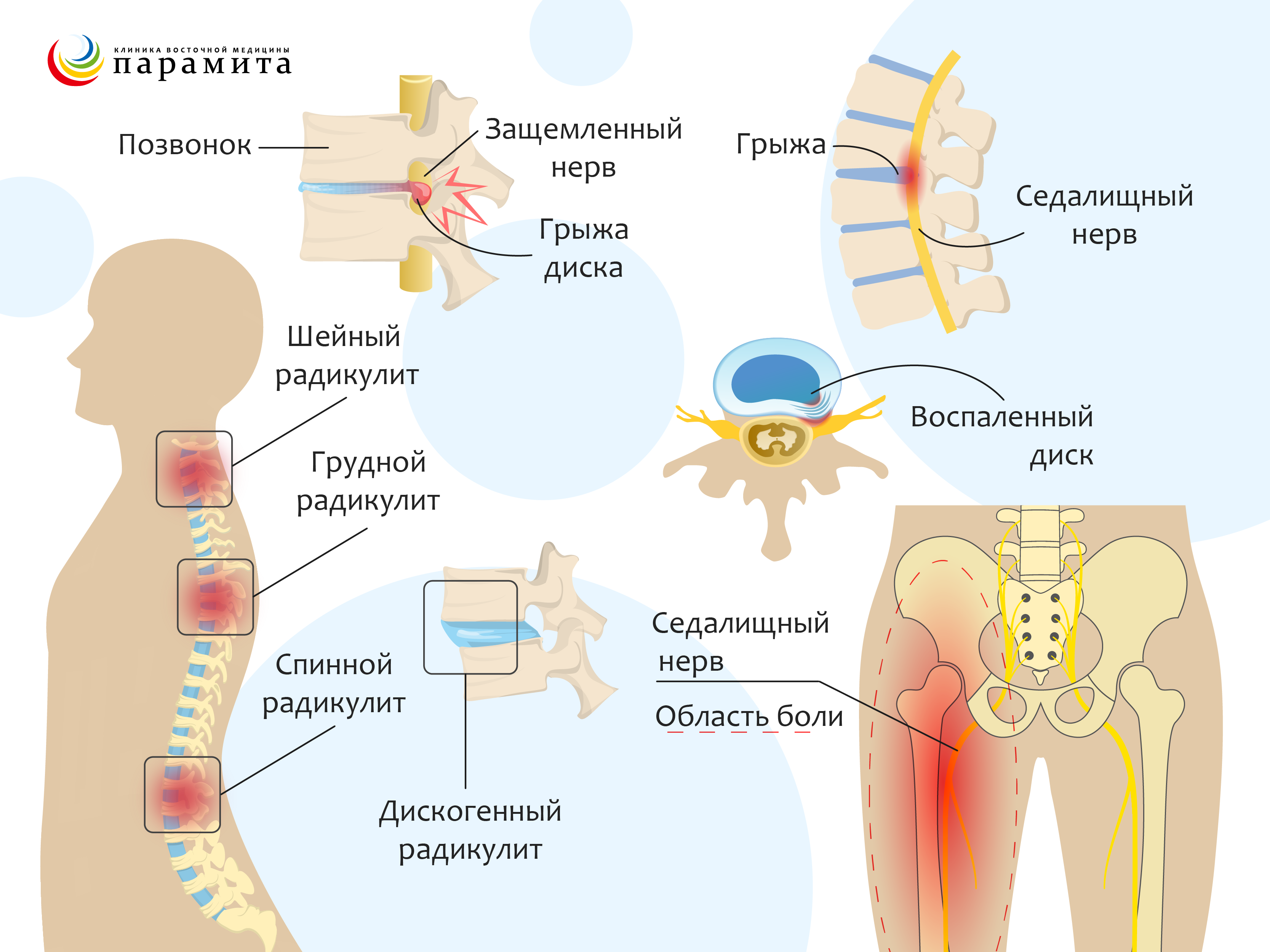 Массаж спины