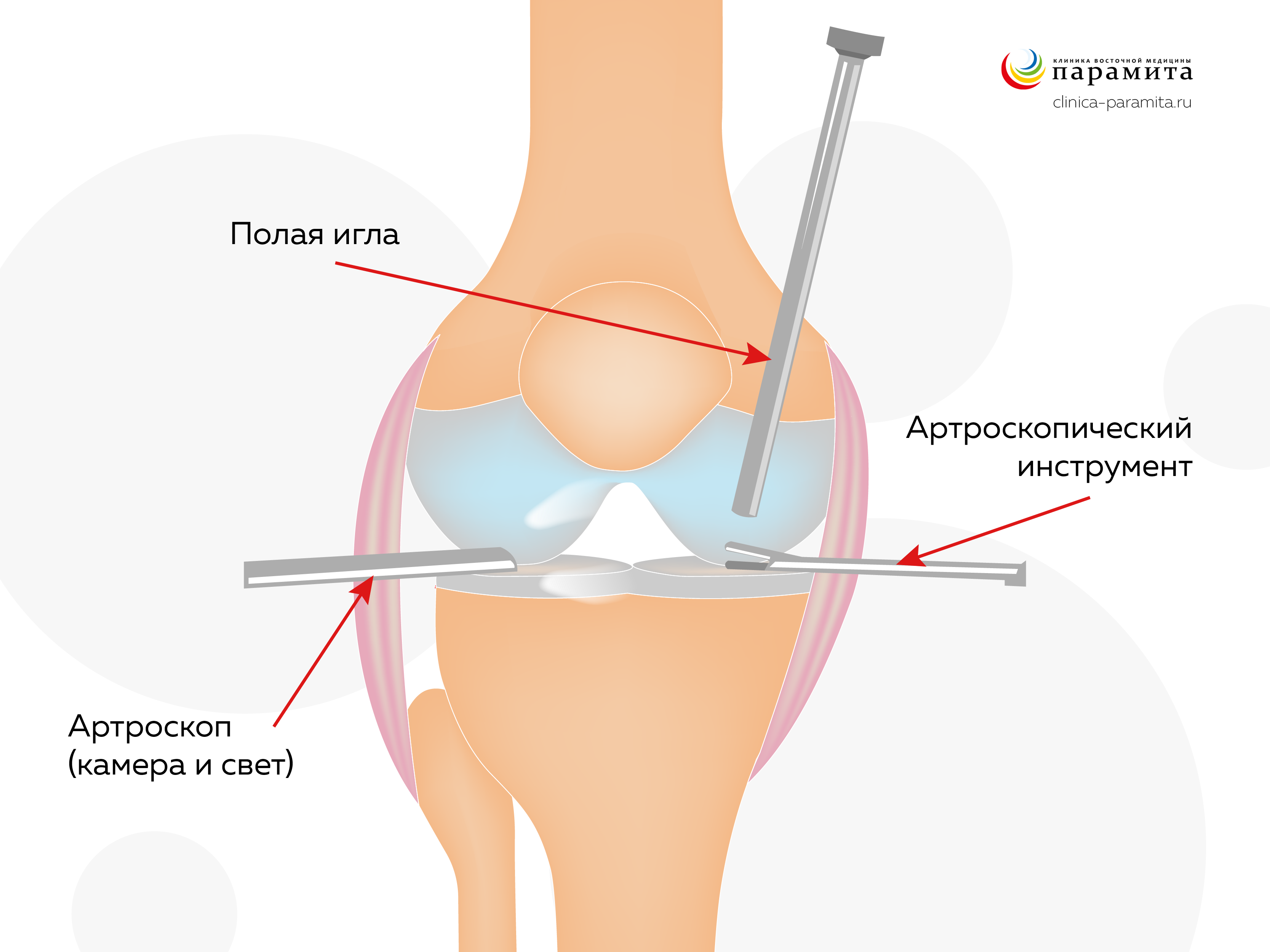 Мази и гели при боли в коленях