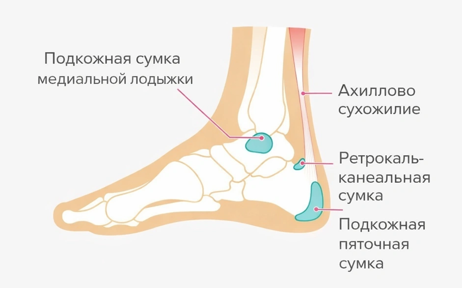 Бурсы в стопе