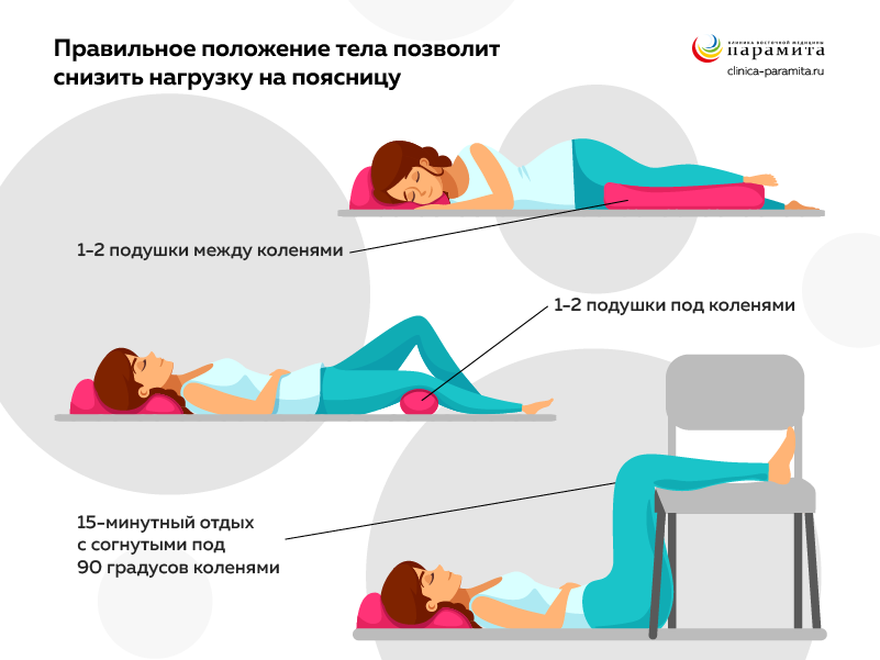 Неправильное спальное место и поза во время сна - причины защемлений седалищного нерва