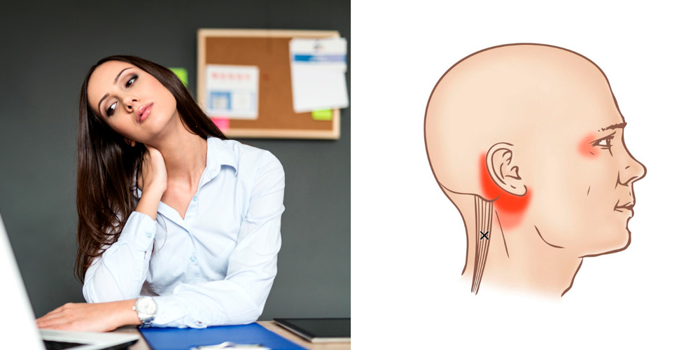 10 эффективных методов для устранения боли в шее