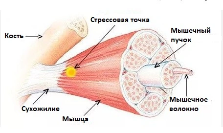 Миозит - частая причина болей в мышцах спины