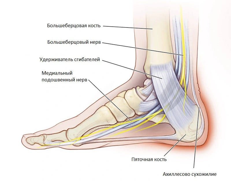 Болит пятка с внутренней стороны стопы - что делать?