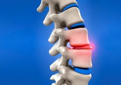 Стадии протекания заболевания