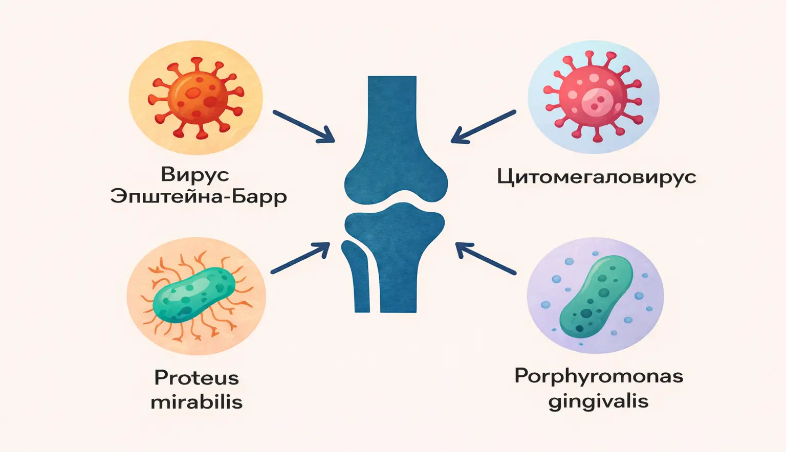 Вирусы и бактерии, способные запускать ревматоидный артрит у женщин