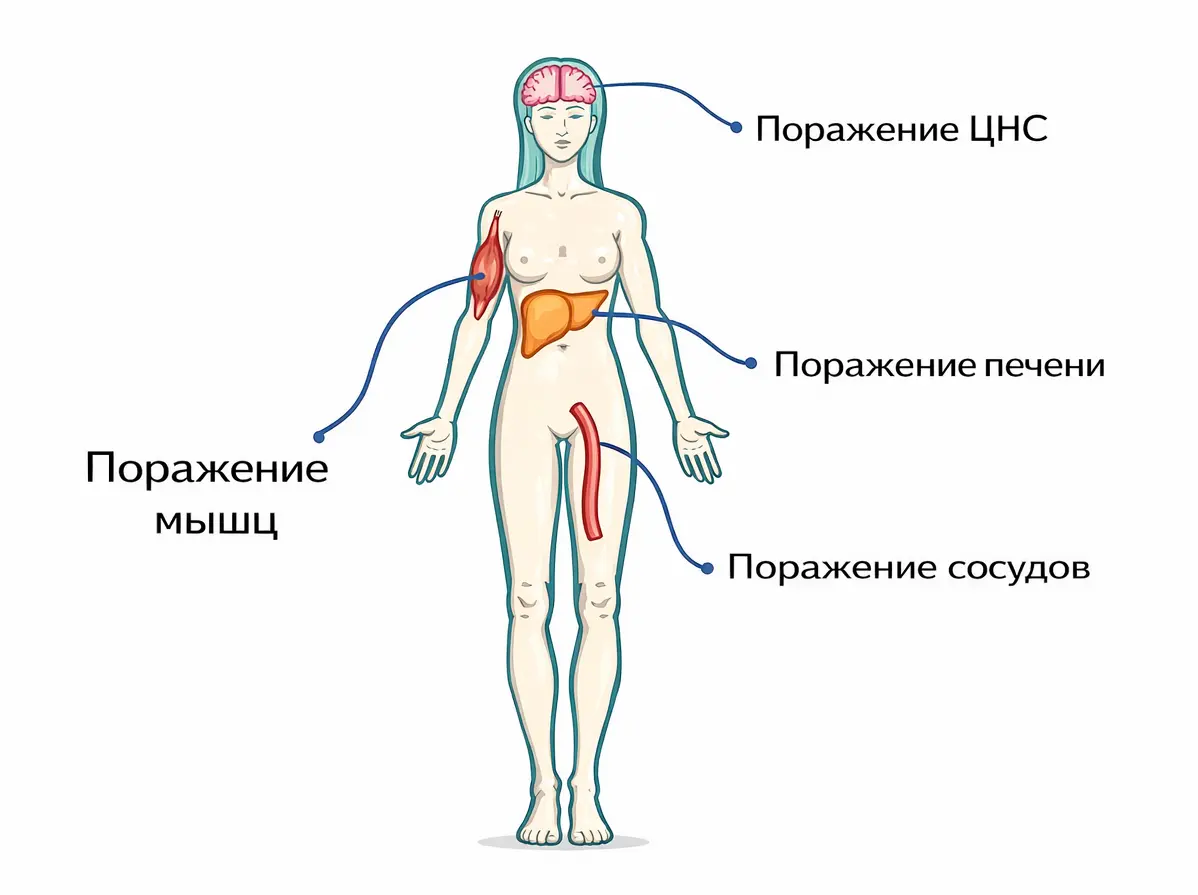 Системное поражение внутренних органов при ревматоидном артрите