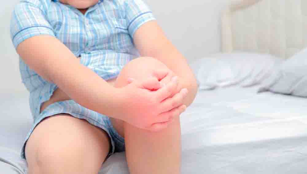 Отек при аллергическом артрите у детей