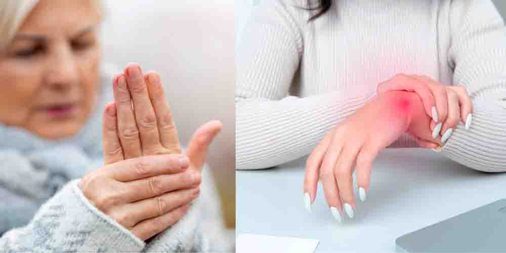 Симптомы артрита кистей рук