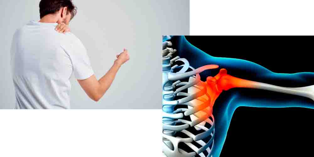 Ревматоидный артрит плечевого сустава