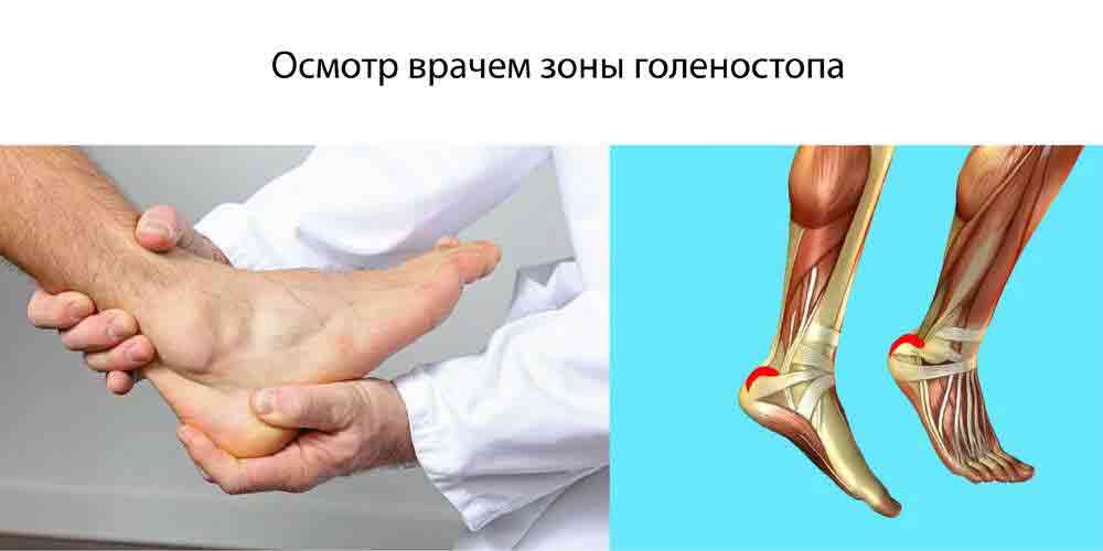 Осмотр врачом травмы ноги