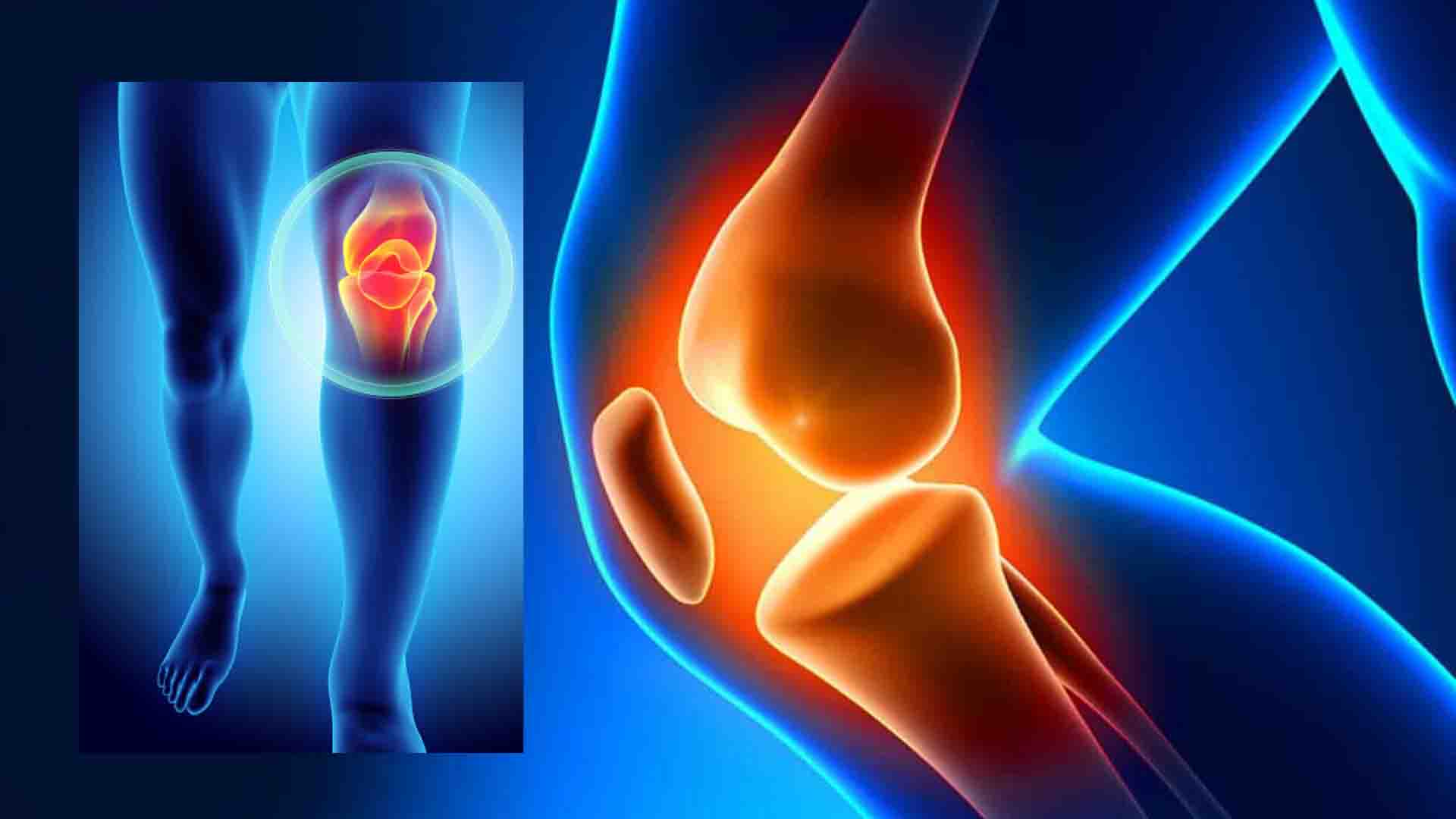Серопозитивный артрит колена