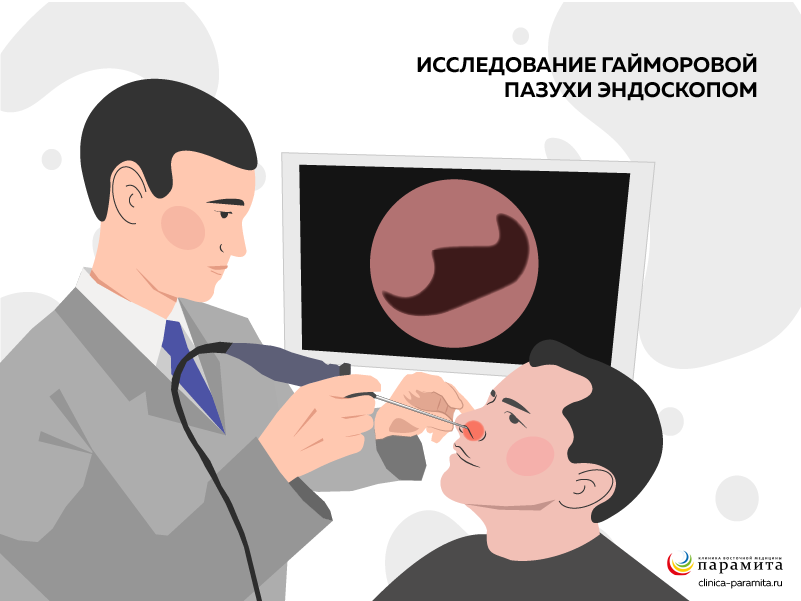 Процедура эндоскопии