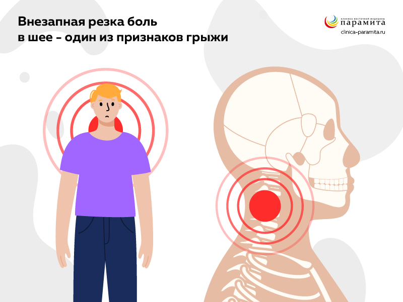 Боль - симптом шейной межпозвоночной грыжи